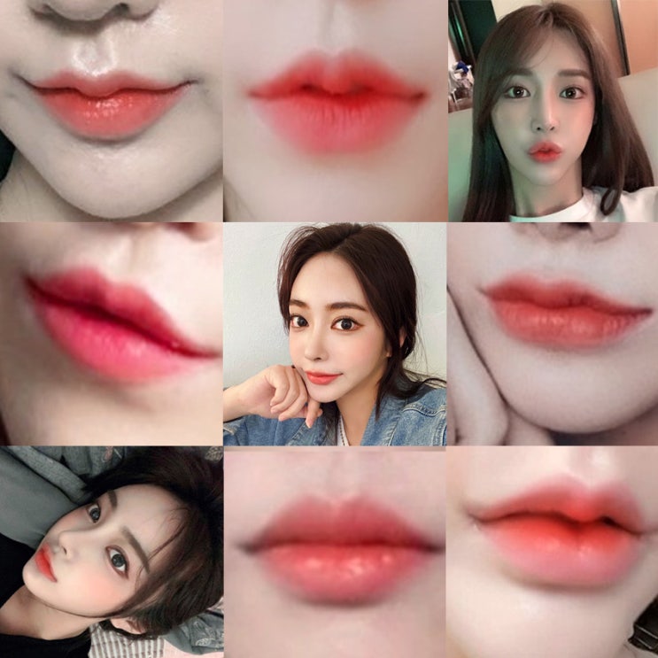 Where mouth corner surgery is done well: the birth of a charming focal point