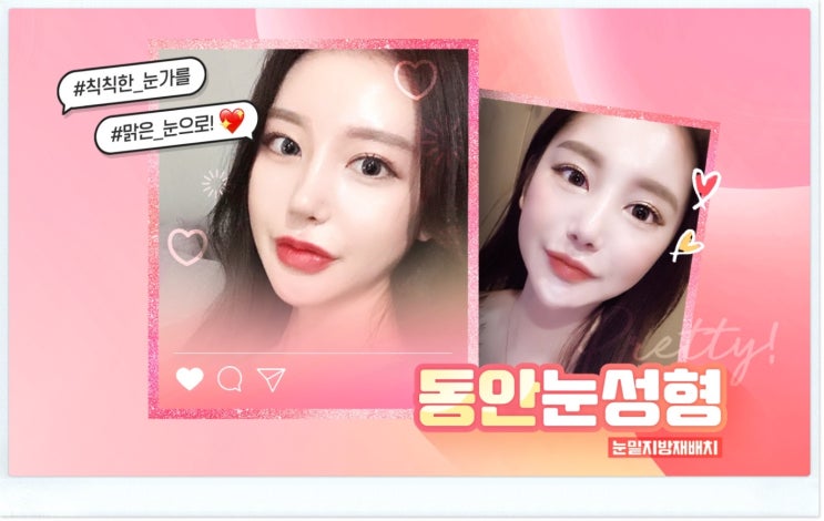 When it comes to Gangnam under-eye fat repositioning, there really is no end to comparing options.