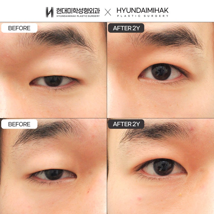 Male Eye Surgery Clinic: The Most Reliable Way to Create a Clear First Impression