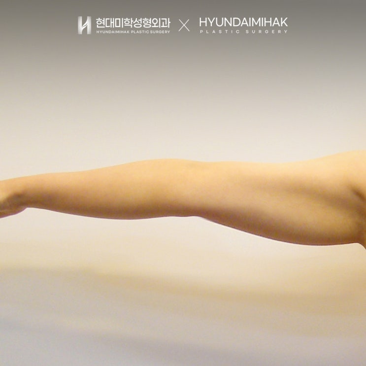 Targeted Liposuction: Now It’s Time to Truly Find Your Own Line