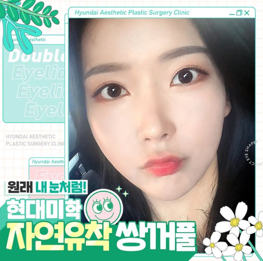 Eye Plastic Surgery for Eyes That Suit You
