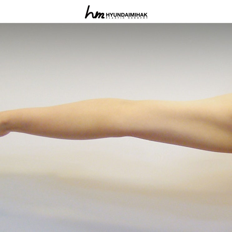 Mini Liposuction: A Delicate Body Contouring Option You Can Start Without Burden