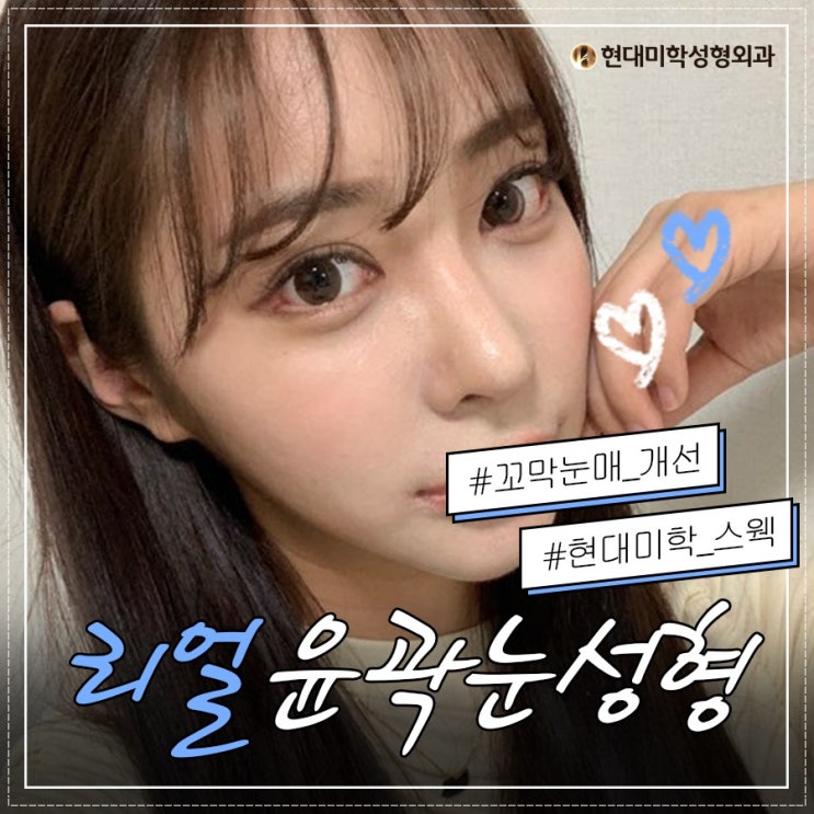 Can a buried double-eyelid surgery review really be this good?