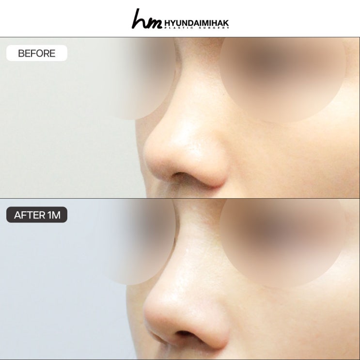 A clinic skilled in rhinoplasty: the beginning of natural, satisfying change