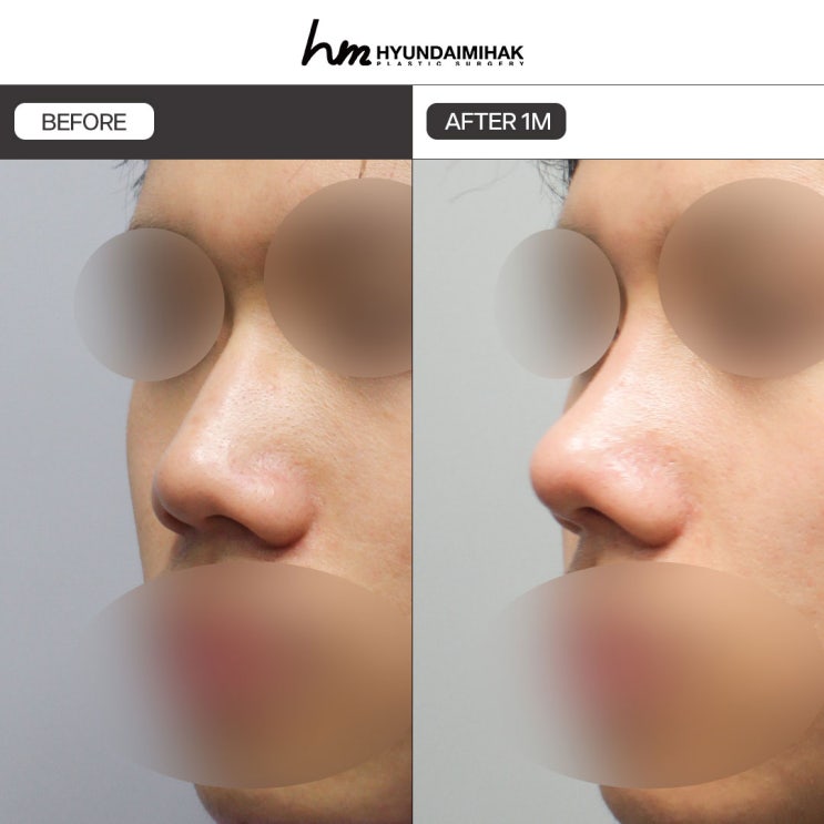 Male Plastic Surgery Reviews: Your Blind Date Success Rate Can Change