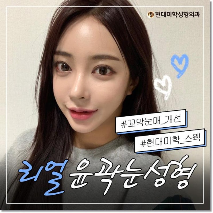 We show you satisfaction with double eyelid surgery costs