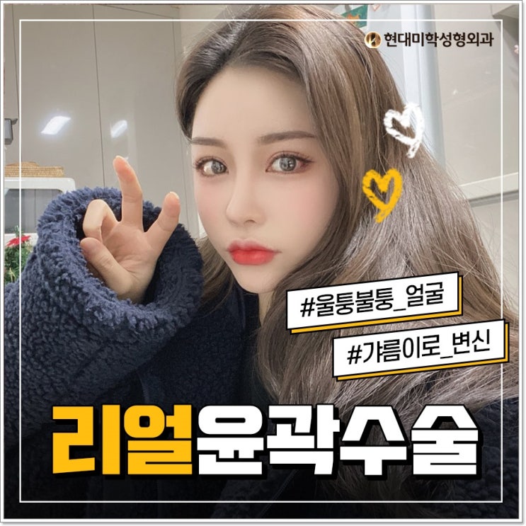 Speaking of facial correction, Hyundai Aesthetic Surgery