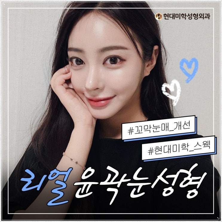 Gangnam Double-Eyelid Revision Surgery: A Renewed Opportunity