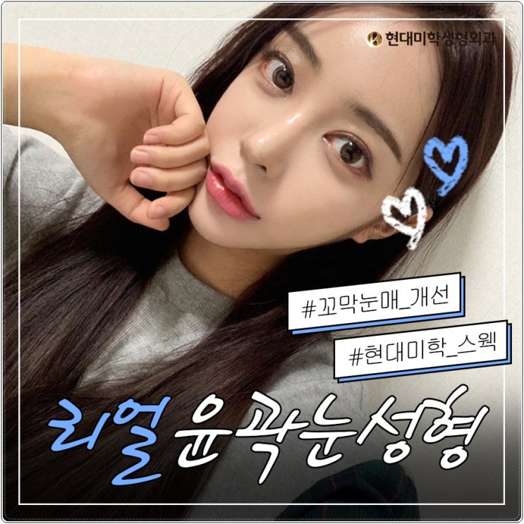 Ptosis Surgery Reviews: Transforming Sleepy-Looking Eyes
