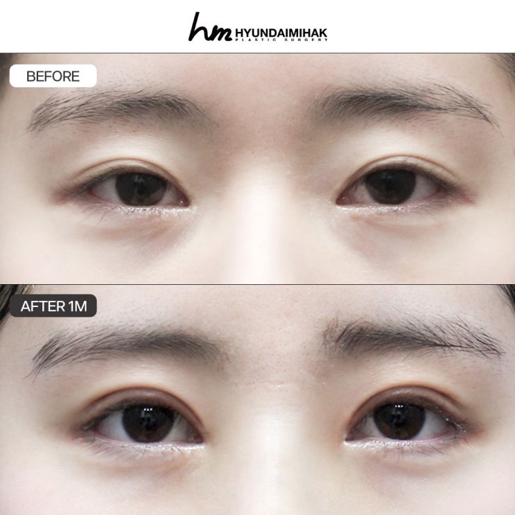 The Right Procedure for the Right Concern: Personalized Plastic Surgery Stories for You