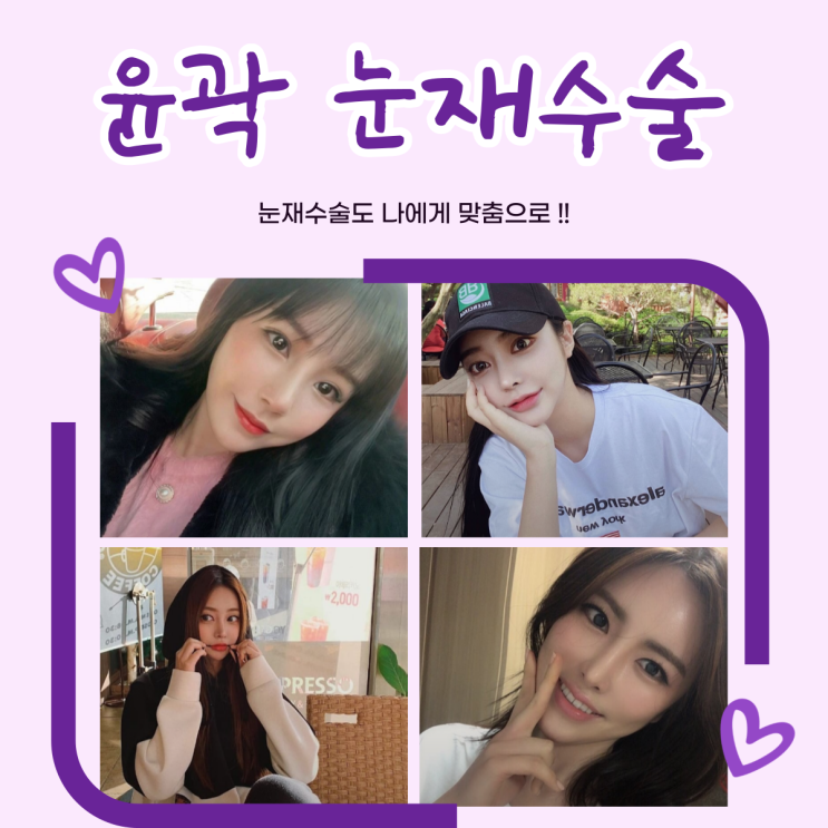 Seoul Eye Revision Surgery: What You Should Know Beforehand.