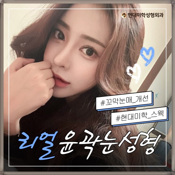 Achieve successful double eyelid revision surgery in Seoul now