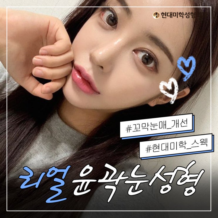 Double eyelid surgery cost, is this for real?