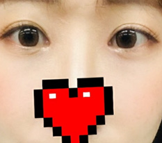 I admit Hyundai Aesthetic Surgery is the eye place bb