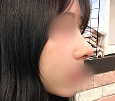 My Face Has More Dimension haha