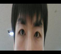 It's embarrassing, but here is an honest review of men's double-eyelid surgery..