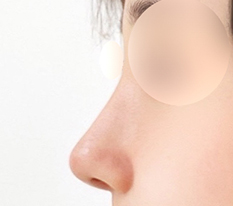 A pretty nose even without retouching lol