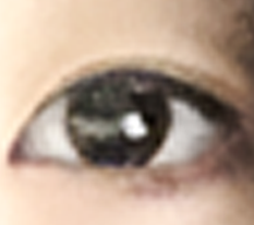 Successful rear and lower canthoplasty haha