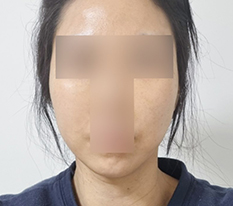 Facial line looks clean -