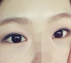Now I know why they say this place is famous for eye surgery!