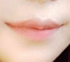 Mouth-corner surgery from Director Hong~~~~