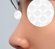 Smoothed out my hooked nose