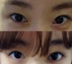 I'm the 10:10 Eyes Girl