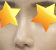 Nose surgery review
