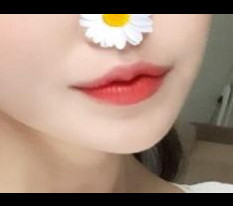 I had mouth-corner surgery heart