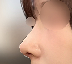Straight-Slope Nose Specialist, Agreed