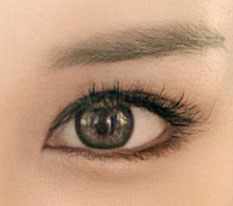 Lateral + lower canthoplasty — truly satisfied!
