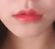 Lip surgery at Hyundai Aesthetic Surgery is seriously highly recommended;