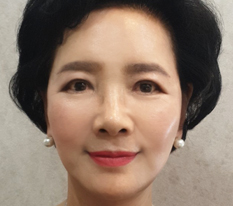 I got a facelift for my mom, who worked hard all her life, and she is so happy