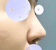 I got a glamorous nose