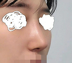 So glad I no longer have to stress about my low nose :)