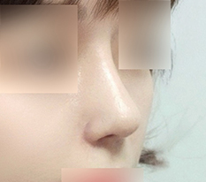 My nose became more defined haha