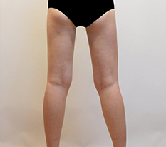 My lower-body line slimmed down well