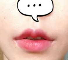 Doesn't my mouth shape look prettier? lol