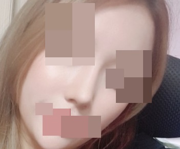 Nose surgery review