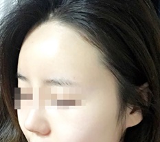 My forehead that feels like mine but not mine :)