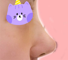 My escape from a flat, blobby nose