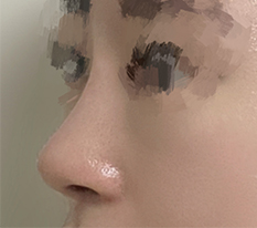 Straight-Slightly Curved Nose Line Review