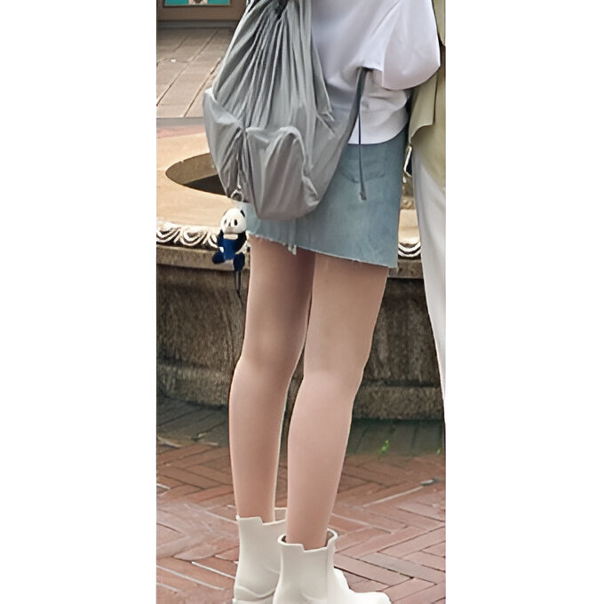 Slim, delicate legs after thigh-hip-knee liposuction! Review