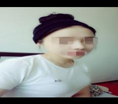 I love the shape of my bridge (4 mm) + tip (septal cartilage) so much♬