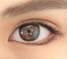 Definitely get the canthoplasty done lol