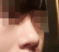They made my male nose perfect too.