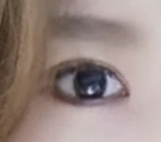 As expected, Hyundai Aesthetic Surgery is Hyundai Aesthetic Surgery