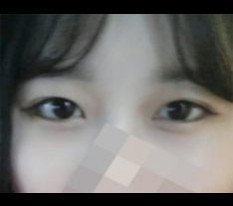 Highly recommend eye surgery!