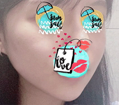 Please let the swelling go down already~~~~~