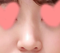 Because of my natural but higher nose!